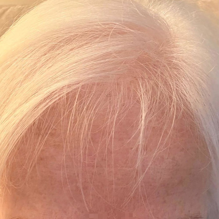 New short hairs growing along the front hairline